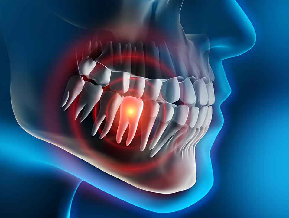 Teeth image - Emergency dentist Lincoln